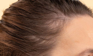 Close-up view of a tan-skinned woman's dark brown hair and scalp, showing signs of hair loss concerns, which could be addressed by Pantene Abundant & Strong products.