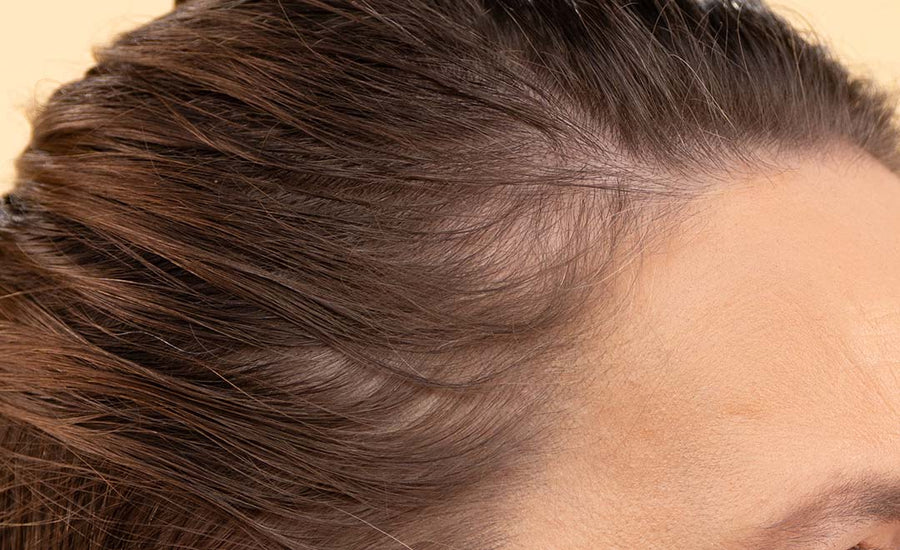 Close-up view of a tan-skinned woman's dark brown hair and scalp, showing signs of hair loss concerns, which could be addressed by Pantene Abundant & Strong products.